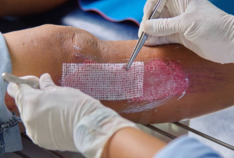 Expert Wound Care in Euclid, Ohio